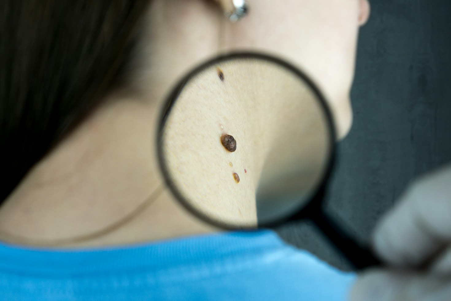 Essential Home Remedies That Truly Support Healing